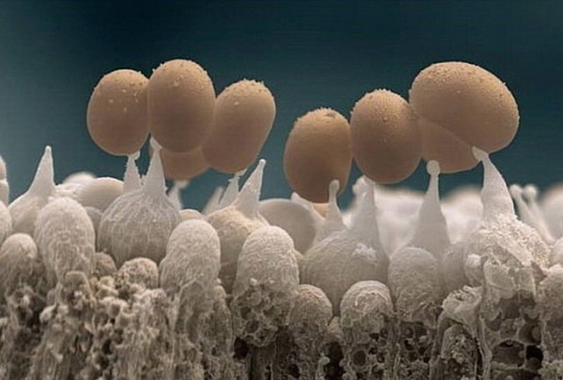 гъбички по ноктите на краката под микроскоп
