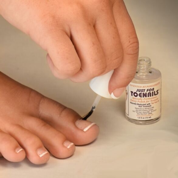 гъбичен лак се използва в ранните етапи на инфекция с гъбички по ноктите