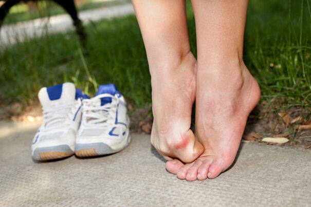сърбеж между пръстите на краката симптоми на гъбички